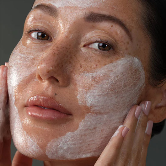 problematic skin